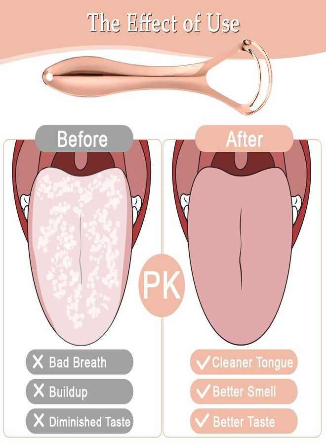 ZIBUYU® Rose Gold Tongue Cleaner for Adults - 2 Pack Stainless Steel Tongue Scraper with Metal Box, Double Layer Design for Effective Bad Breath Removal, 100% BPA-Free - Image 5